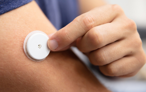 Image of a continuous glucose monitor on arm
