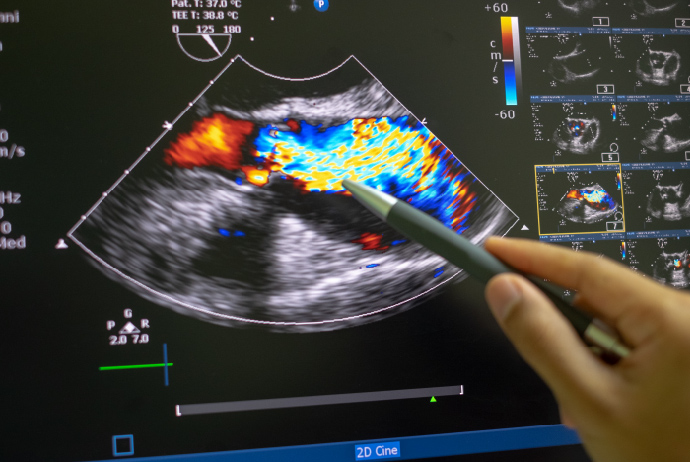 An image of a colorized echocardiogram or ECG